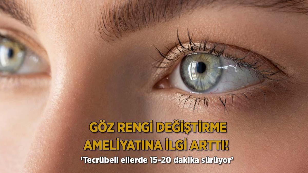 Göz rengi değiştirme ameliyatına ilgi arttı! ‘Tecrübeli ellerde 15-20 dakika sürüyor’